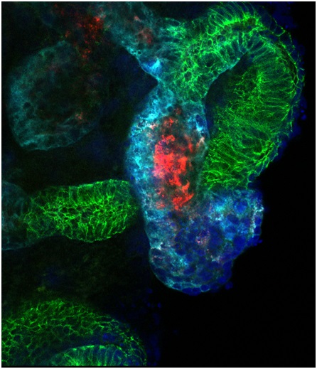 kidney organoid